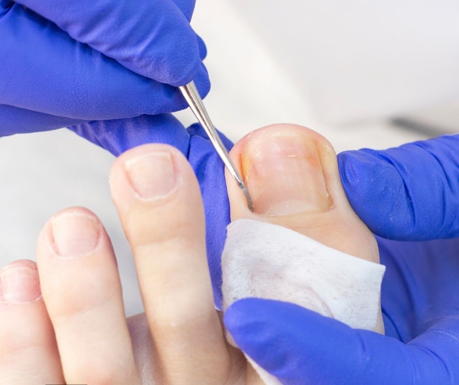 Treatment Image