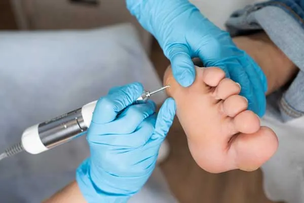 Treatment Image 2