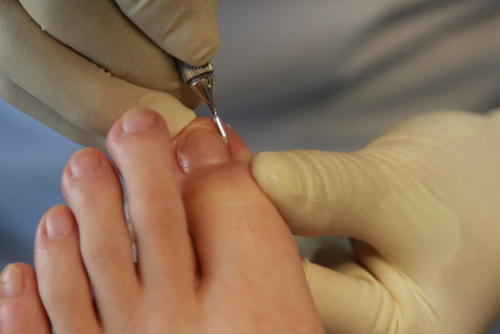 Treatment Image 2