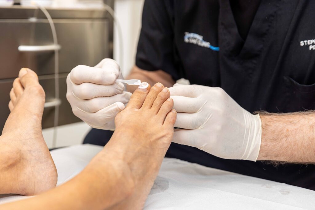 Treatment Image